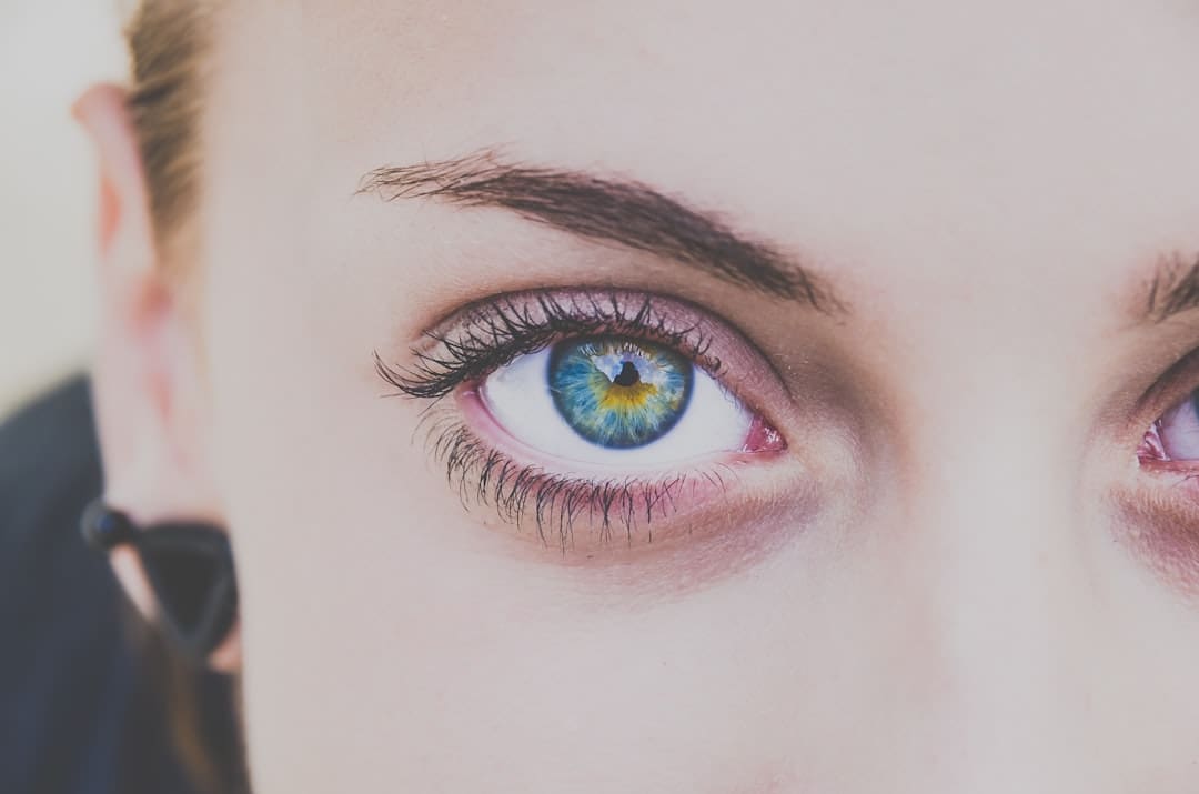 Dry Eyes from Contacts: Understanding the Causes